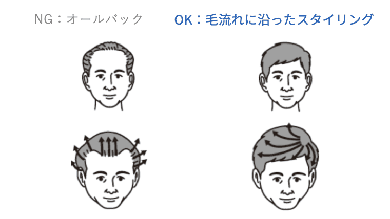 「生え際の後退は「毛流れ」でカバーする」と題された比較図。「NG：オールバック」として生え際の後退が目立つ髪型と、「OK：毛流れに沿ったスタイリング」として髪の流れで生え際を自然にカバーしている髪型が、イラストで比較されている。